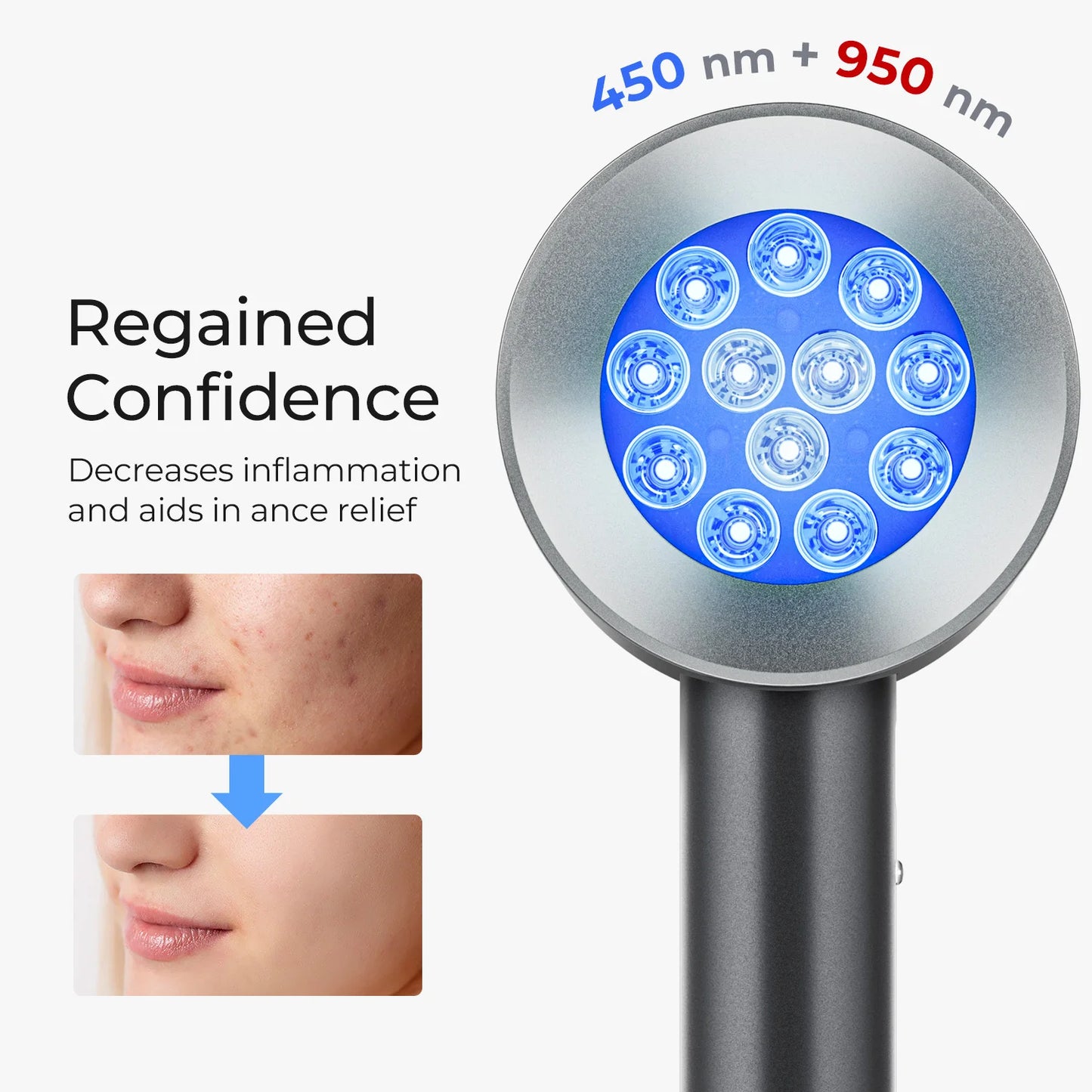 Infrared Facial Therapy Lamp: Anti-aging, Anti-acne, Wrinkle, Dark Circle and Blemish Eliminator.