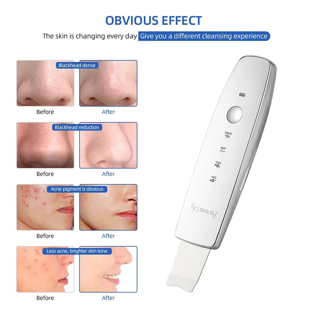 6 in 1 Ultrasonic Facial Scrubber with Red and Blue LED Photon Therapy