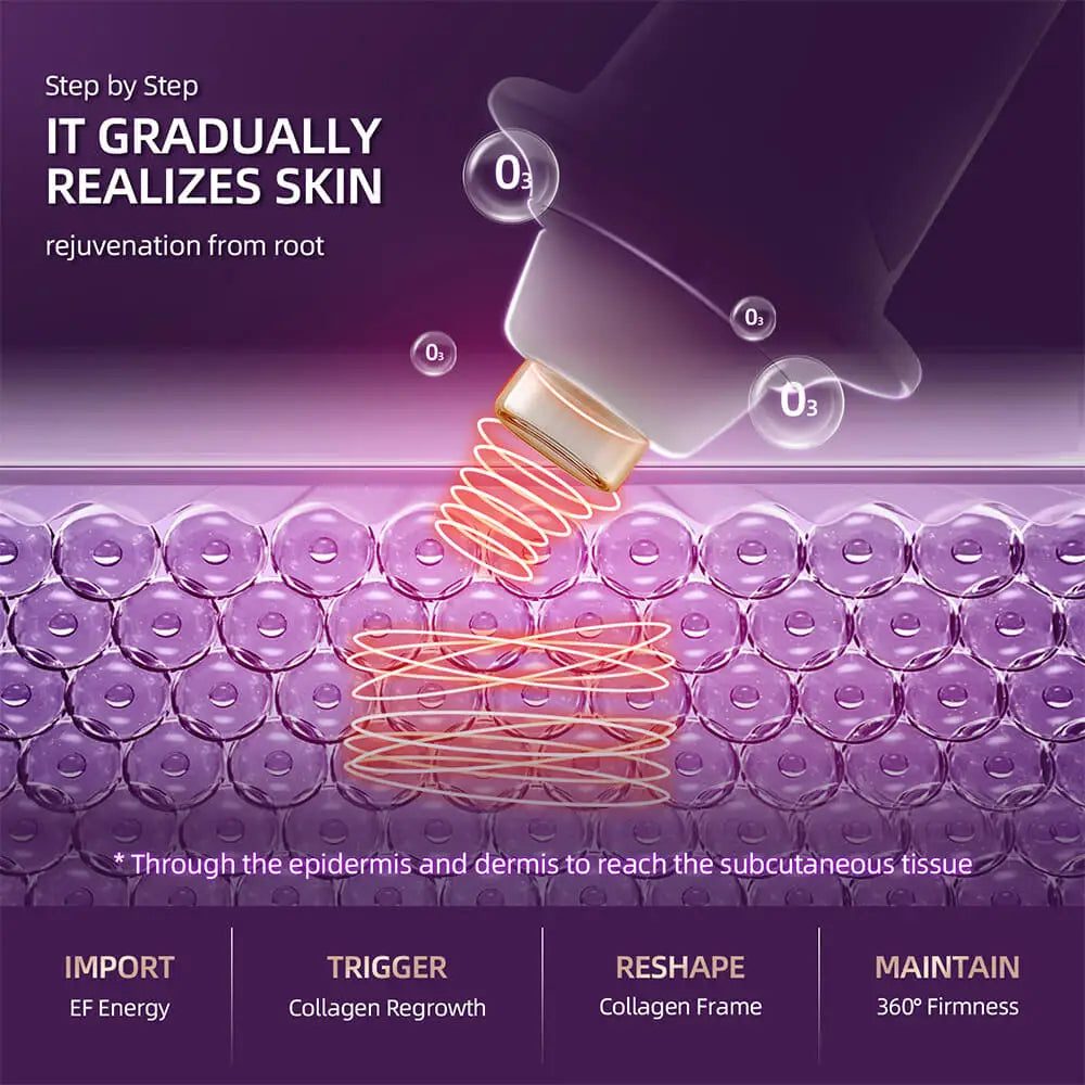 Radiofrequency Facial Lifting EMS Microcurrent. Skin Tightening