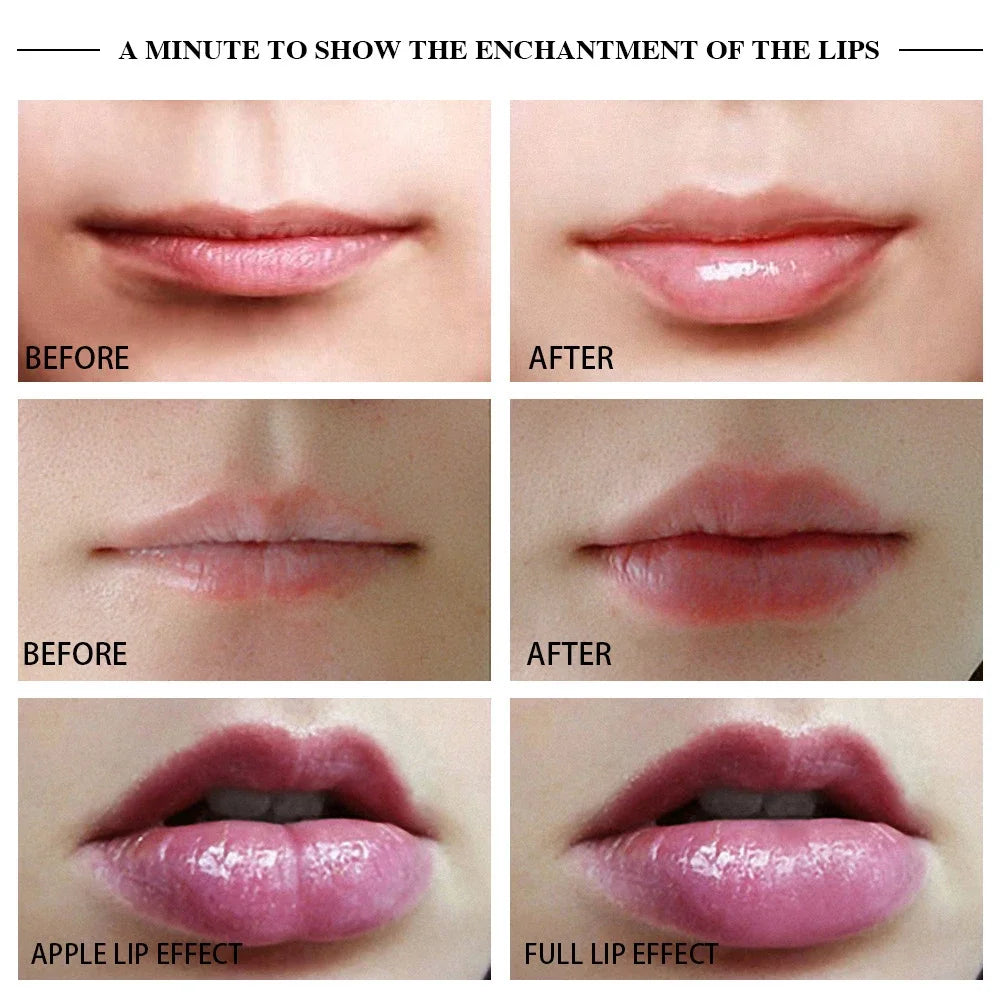 Dispositivo para el Cuidado de Labios para Mujeres. Aumento de Volumen.