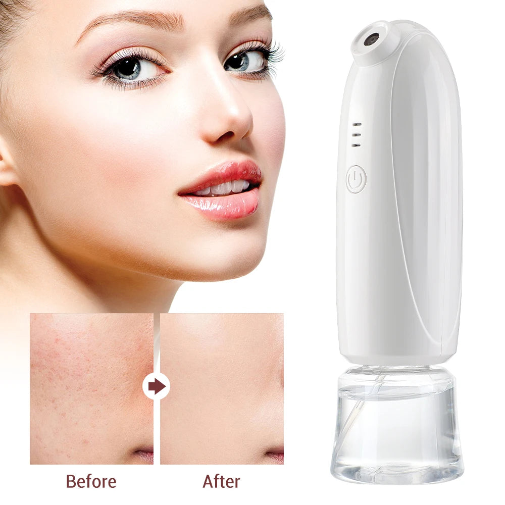 Oxygen Injector for Skin Rejuvenation and Hydration