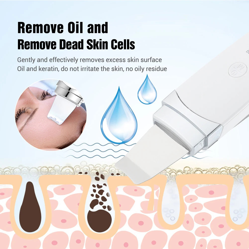 Ultrasonic Skin Cleaner. Blackhead Remover